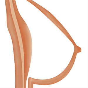 Sex Doll Hollow Breasts
