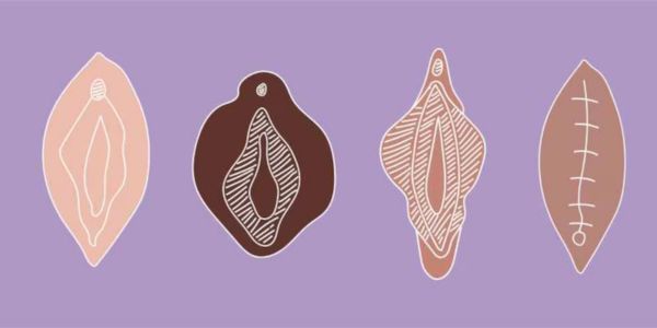 What is Infibulation