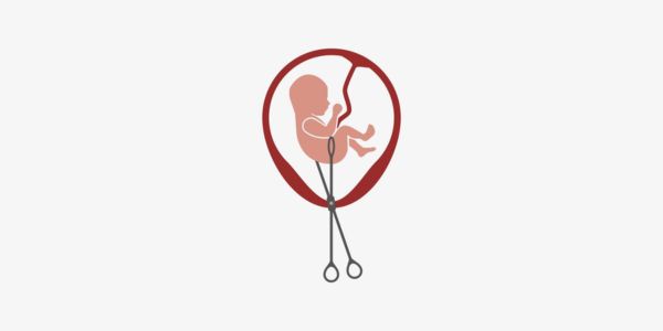 What is Partial Birth Abortion