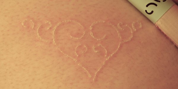 What is Scarification